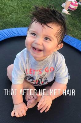 That showing off his “helmet hair” after taking off his cranial orthosis.