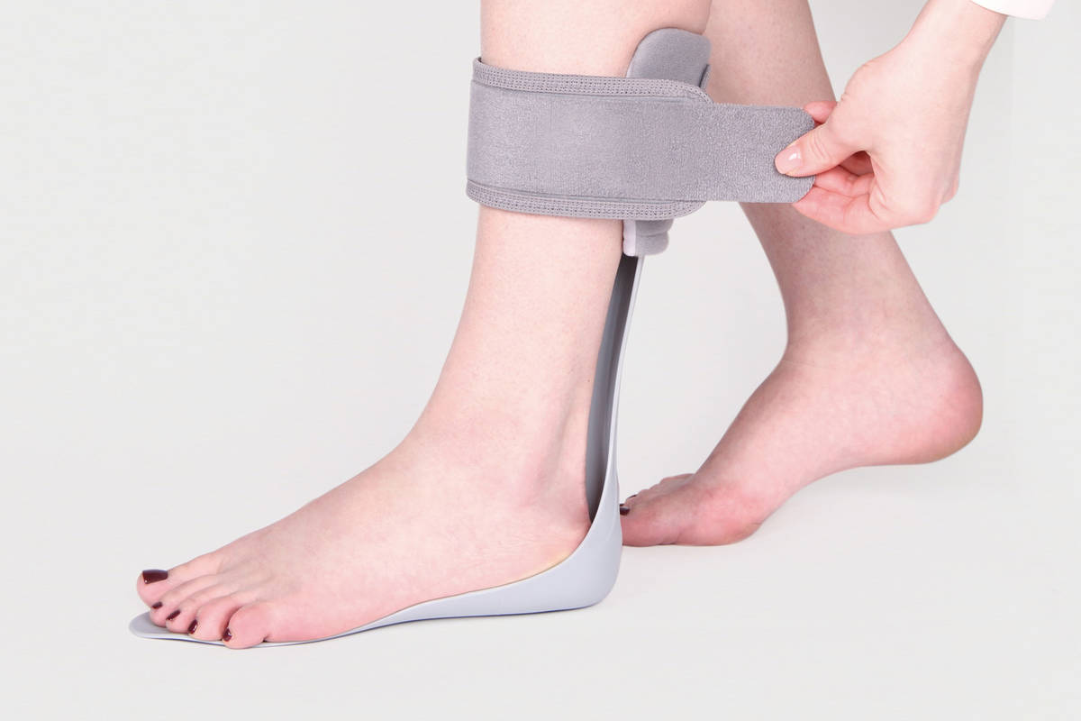 AFO PLS – Posterior Leaf Spring Ankle Foot Orthosis (Custom)