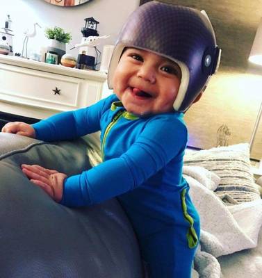 Happy baby wearing his new cranial orthosis!